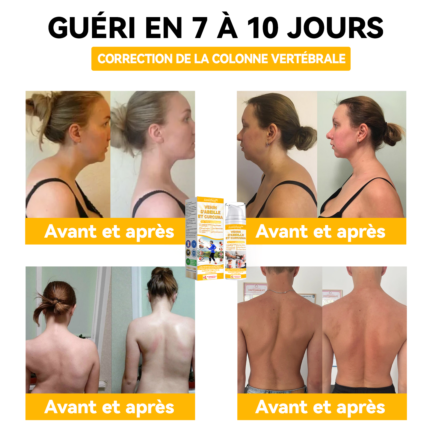 Il ne reste plus que 5 bouteilles ! 30% de réduction supplémentaire ! Les chirurgiens orthopédiques affirment que le rétablissement complet peut être atteint après 4 à 6 bouteilles ! 💥