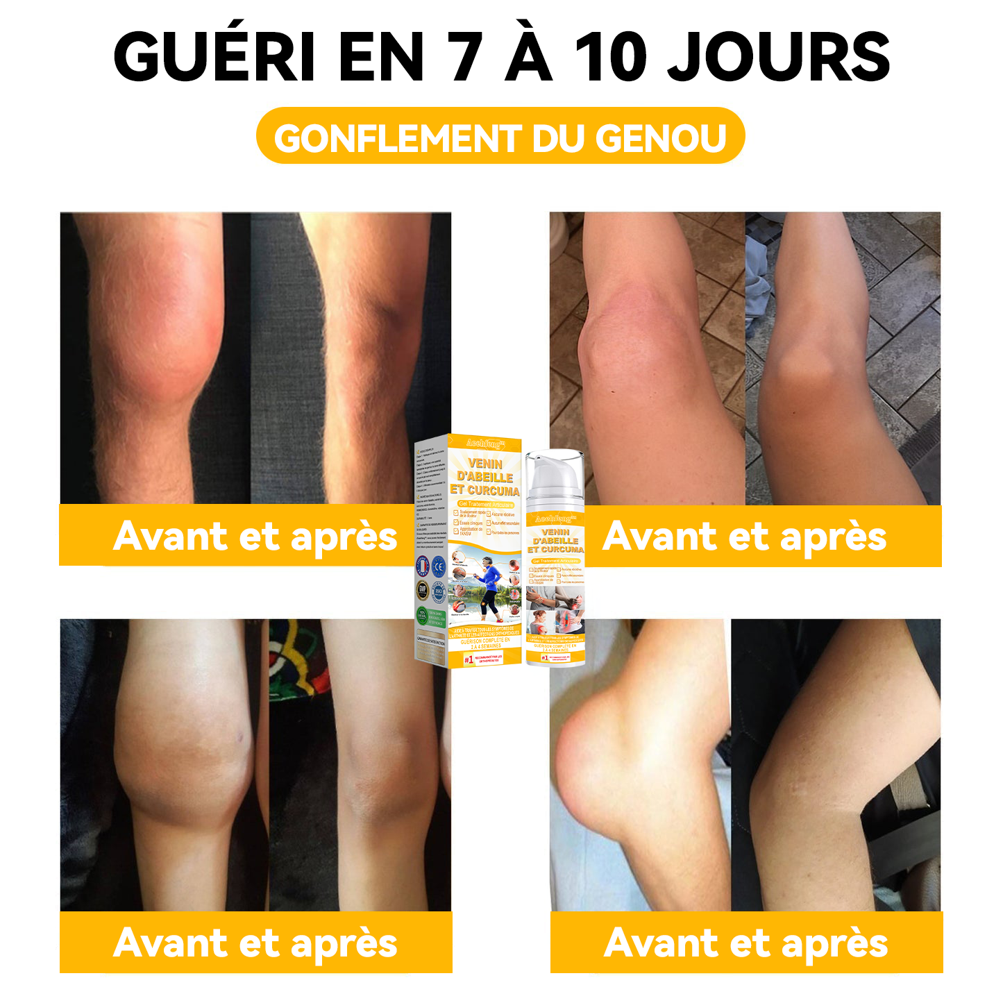 Il ne reste plus que 5 bouteilles ! 30% de réduction supplémentaire ! Les chirurgiens orthopédiques affirment que le rétablissement complet peut être atteint après 4 à 6 bouteilles ! 💥