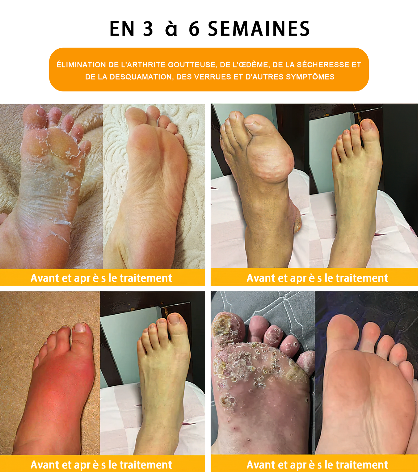 Aeehfeng™ 30 perles de bain détoxifiantes et amincissantes aux herbes💁‍♀️(Recommandé par l'Association Lymphatique Française)👩‍⚕️