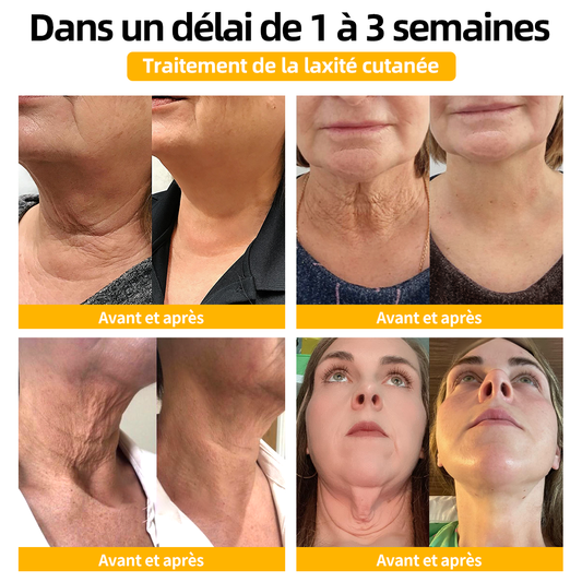 Il ne reste que 8 boîtes ! Nous vous offrons en plus une remise de 30% ! 🏆 Recommandé par des dermatologues, 4 à 6 boîtes restaureront votre peau parfaite ! Si vous manquez cette opportunité, il faudra attendre un an avant qu'elle ne revienne !🏆