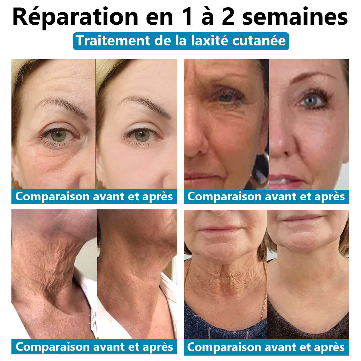 Il ne reste plus que 5 bouteilles ! Nous vous offrons une réduction supplémentaire de 30% ! Les dermatologues recommandent d'utiliser 3 à 5 flacons pour garantir une peau saine ! Si vous manquez cette opportunité, vous devrez attendre l'année prochaine !🌞