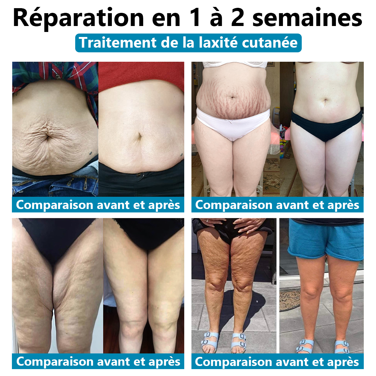 Il ne reste plus que 5 bouteilles ! Nous vous offrons une réduction supplémentaire de 30% ! Les dermatologues recommandent d'utiliser 3 à 5 flacons pour garantir une peau saine ! Si vous manquez cette opportunité, vous devrez attendre l'année prochaine !🌞