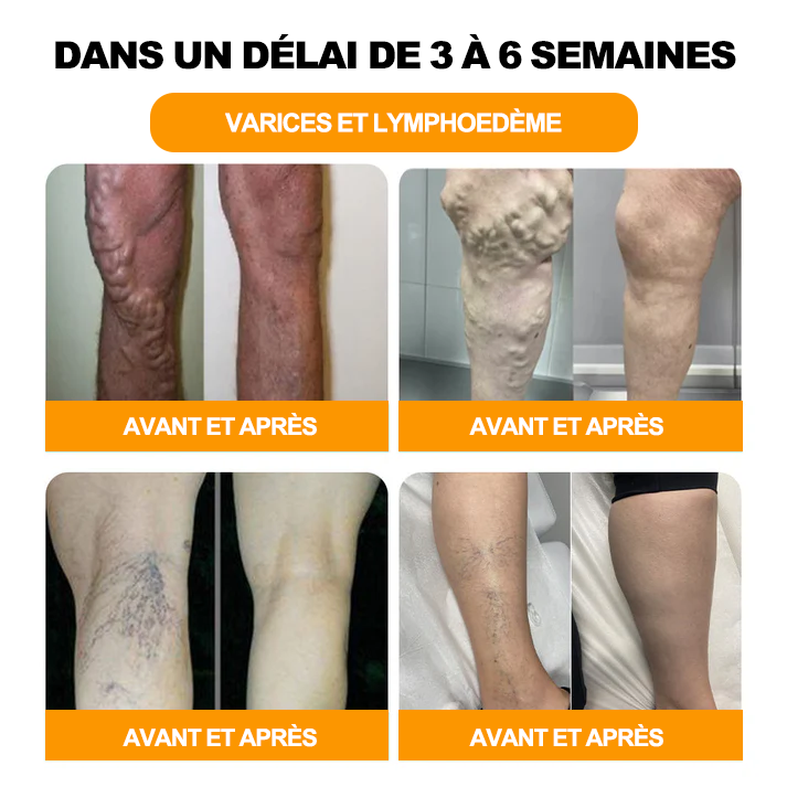 Aeehfeng™ 30 perles de bain détoxifiantes et amincissantes aux herbes💁‍♀️(Recommandé par l'Association Lymphatique Française)👩‍⚕️