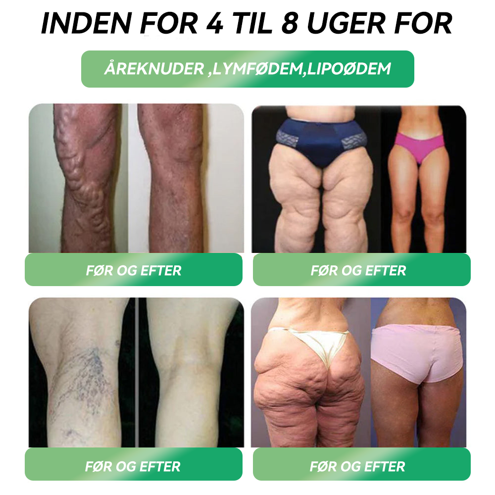 𝐎𝐟𝐟𝐢𝐜𝐢𝐞𝐥 𝒃𝒖𝒕𝒊𝒌 | 𝐇𝐻𝑽𝐁® 💫 𝐆𝐋𝑷-1 𝑆𝐼𝑿-𝐼N-𝐎𝐍E 𝑺𝒖𝒏𝒅𝒉𝒆𝒅sløsning 𝑶𝒓al 𝑽æ𝒔ke (𝑲𝒖𝒏 é𝒏 𝒈𝒂𝒏𝒈 𝒐𝒎 𝒅𝒂𝒈𝒆𝒏, 𝒔𝒚𝒏𝒍𝒊𝒈𝒆 𝒓𝒆𝒔𝒖𝒍𝒕𝒂𝒕𝒆𝒓 𝒑å 7 𝒅𝒂𝒈𝒆) 👩‍⚕️ 𝑻𝒊𝒍 𝒇𝒆𝒅𝒎𝒆, 𝒉𝒋𝒆𝒓𝒕𝒆-𝒌𝒂𝒓-𝒔𝒖𝒏𝒅𝒉𝒆𝒅, 𝒅𝒊𝒂𝒃𝒆𝒕𝒆𝒔, 𝒔ø𝒗𝒏𝒂𝒑𝒏ø, 𝒕𝒂𝒓𝒎𝒉𝒆𝒍𝒃𝒓𝒆𝒅, 𝒍𝒆𝒅𝒔𝒎𝒆𝒓𝒕𝒆𝒓 𝒐𝒈 𝒎𝒆𝒈𝒆𝒕 𝒎𝒆𝒓𝒆