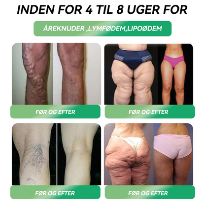 𝐎𝐟𝐟𝐢𝐜𝐢𝐞𝐥 𝒃𝒖𝒕𝒊𝒌 | 𝐇𝐻𝑽𝐁® 💫 𝐆𝐋𝑷-1 𝑆𝐼𝑿-𝐼N-𝐎𝐍E 𝑺𝒖𝒏𝒅𝒉𝒆𝒅sløsning 𝑶𝒓al 𝑽æ𝒔ke (𝑲𝒖𝒏 é𝒏 𝒈𝒂𝒏𝒈 𝒐𝒎 𝒅𝒂𝒈𝒆𝒏, 𝒔𝒚𝒏𝒍𝒊𝒈𝒆 𝒓𝒆𝒔𝒖𝒍𝒕𝒂𝒕𝒆𝒓 𝒑å 7 𝒅𝒂𝒈𝒆) 👩‍⚕️ 𝑻𝒊𝒍 𝒇𝒆𝒅𝒎𝒆, 𝒉𝒋𝒆𝒓𝒕𝒆-𝒌𝒂𝒓-𝒔𝒖𝒏𝒅𝒉𝒆𝒅, 𝒅𝒊𝒂𝒃𝒆𝒕𝒆𝒔, 𝒔ø𝒗𝒏𝒂𝒑𝒏ø, 𝒕𝒂𝒓𝒎𝒉𝒆𝒍𝒃𝒓𝒆𝒅, 𝒍𝒆𝒅𝒔𝒎𝒆𝒓𝒕𝒆𝒓 𝒐𝒈 𝒎𝒆𝒈𝒆𝒕 𝒎𝒆𝒓𝒆